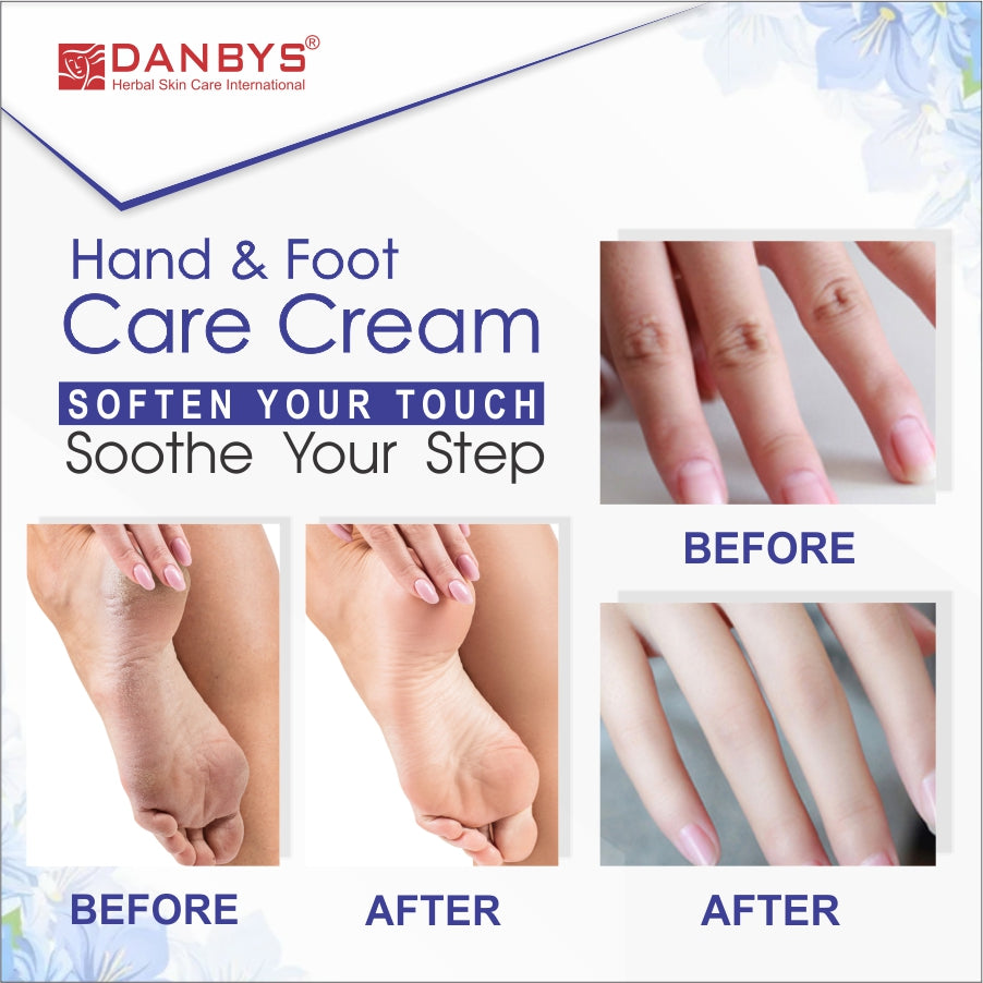 Foot and Hand Whitening Cream