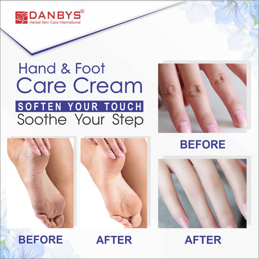 Foot and Hand Whitening Cream
